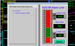 Alarms