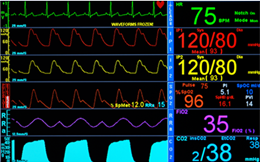 Waveforms